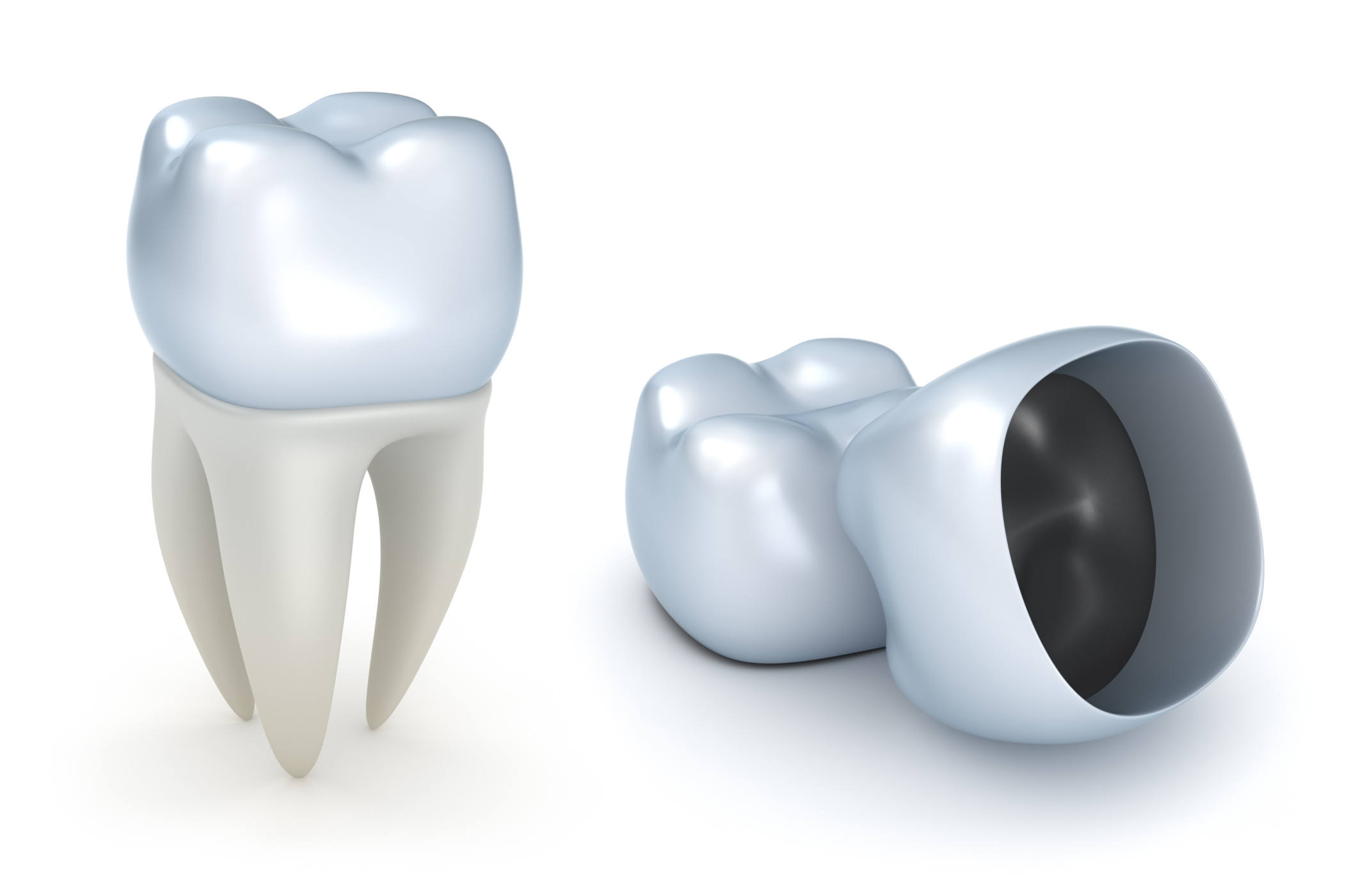 Dental Crowns can be a Highly Beneficial Form of Cosmetic Dentistry