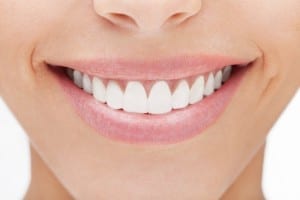 bonded fillings