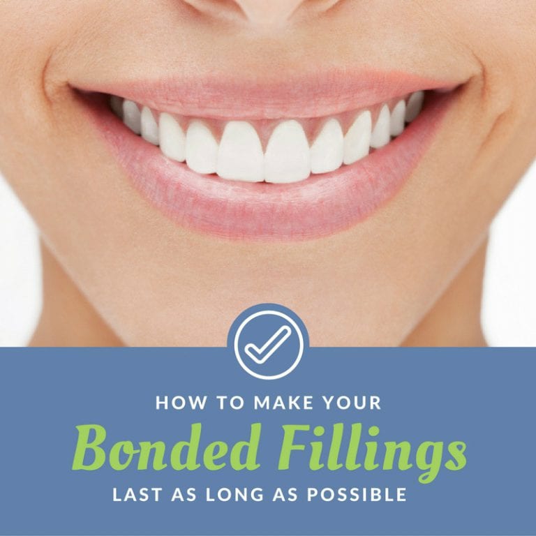 How to Make Your Bonded Fillings Last as Long as Possible