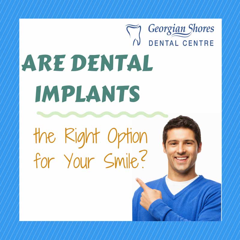 Are Dental Implants the Right Option for Your Smile?