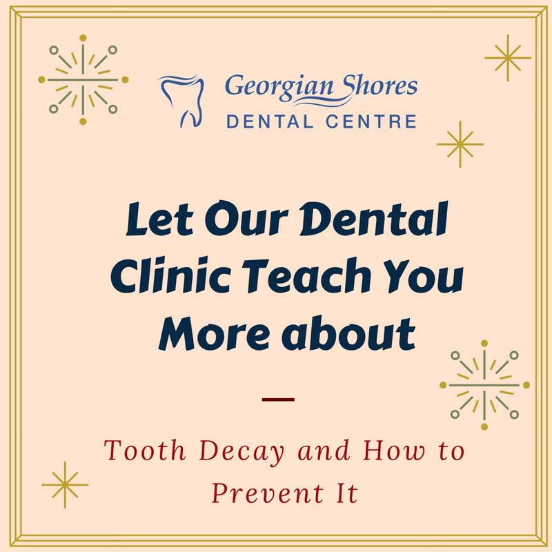Let Our Dental Clinic Teach You More about Tooth Decay and How to Prevent It