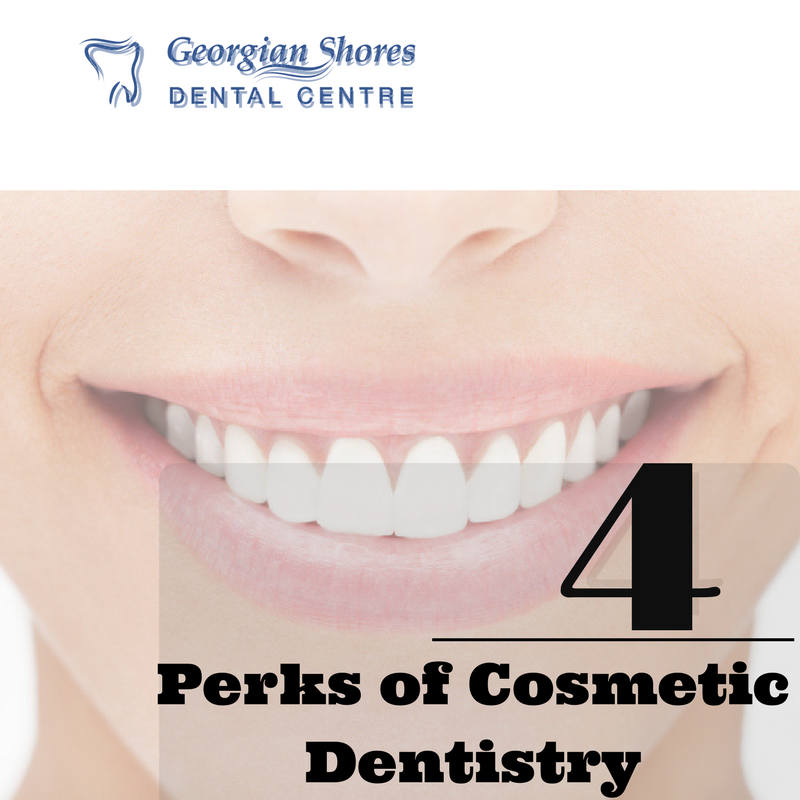 Four Perks of Cosmetic Dentistry