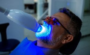 What You Need to Know About Teeth Whitening