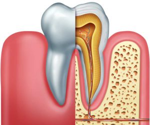 What You Need to Know About Root Canals