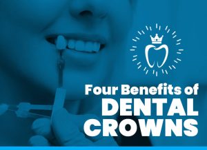 Four Benefits of Dental Crowns