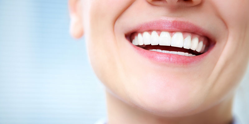 How to Maintain Your Smile After Teeth Whitening